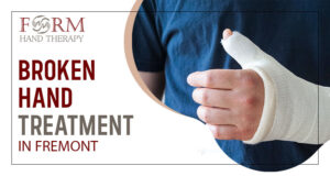 Broken Hand Treatment in Fremont